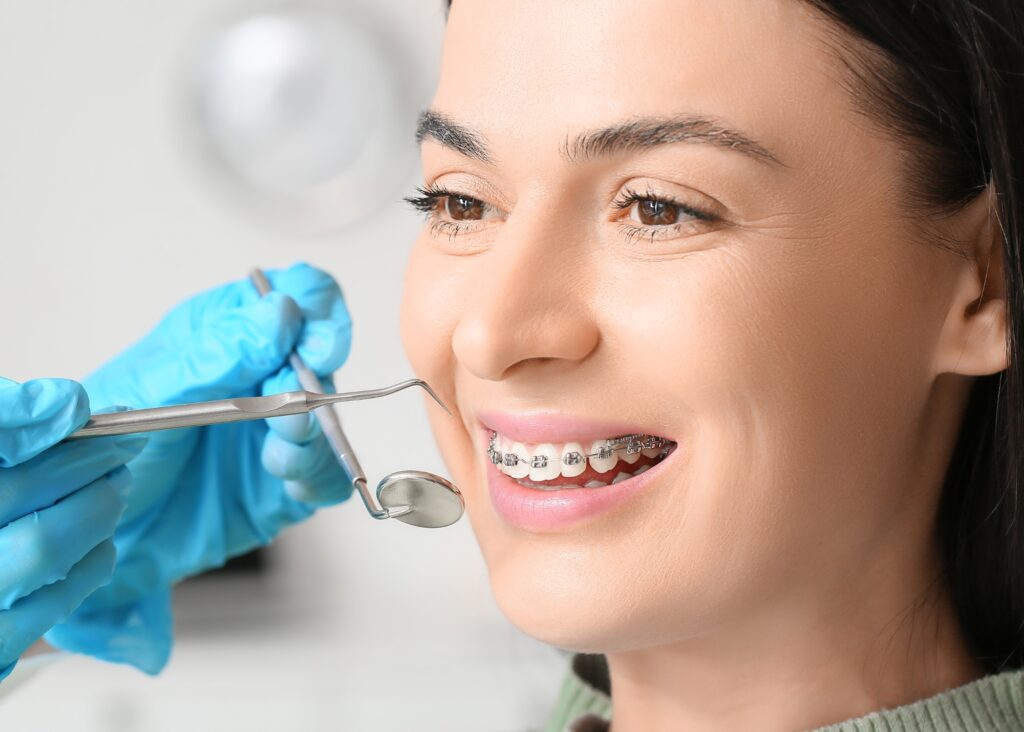 O uso de aparelhos dentários têm se tornado cada vez mais comum, tanto para crianças quanto para adultos. Se você está considerando iniciar um tratamento ortodôntico ou apenas deseja entender melhor como funcionam os aparelhos dentários, este guia é para você. Vamos explorar tudo o que você precisa saber sobre aparelho dentário, desde o funcionamento até os cuidados necessários.