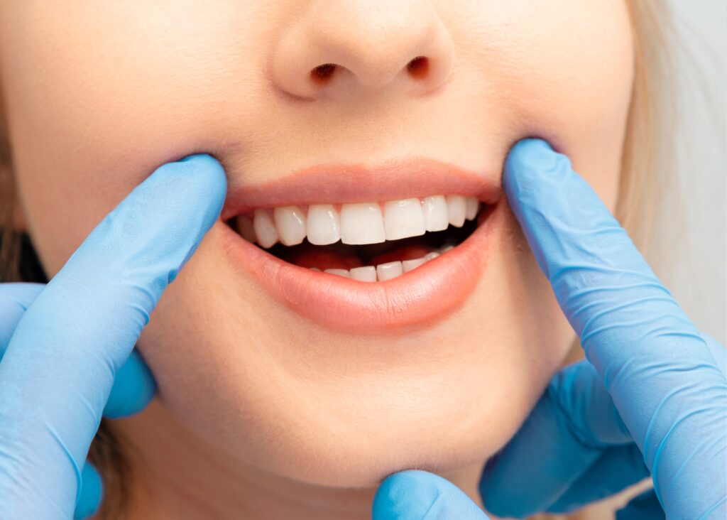 Entenda como funciona o clareamento dental, dicas de segurança e cuidados para manter dentes mais brancos de forma saudável.
